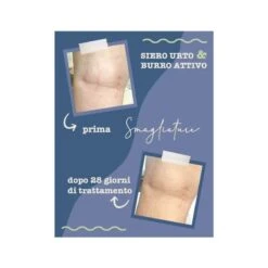 La Saponaria Siero Urto Smagliature 100ml -Cosmetici Sconto Negozio doccia shampoo barca mare camp 984520027 1 4 1668417434