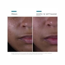 Skinceuticals SILYMARIN Siero Antiossidante Per Pelle A Tendenza Acneica 30 Ml -Cosmetici Sconto Negozio plak spray per il cavo orale con clorexidina 0 1 50ml 6 1665657447